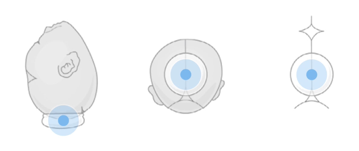 VACCA ACADEMY Official Academy Education for VacuumAssisted Delivery